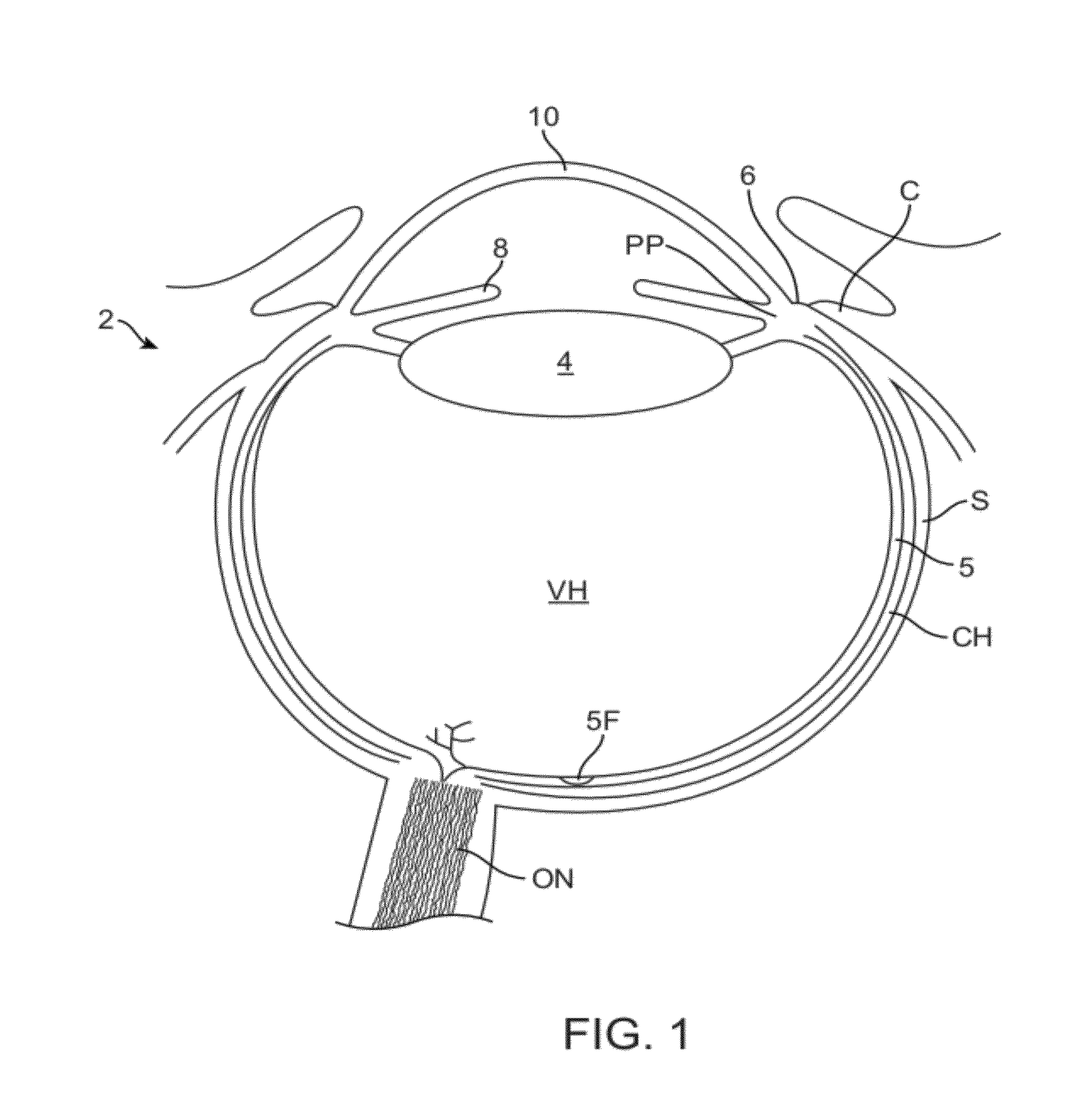 Conformable Therapeutic Shield for Vision and Pain