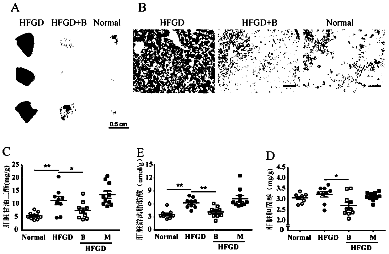 A kind of medicine for preventing and treating fatty liver and obesity and its application in pharmacy