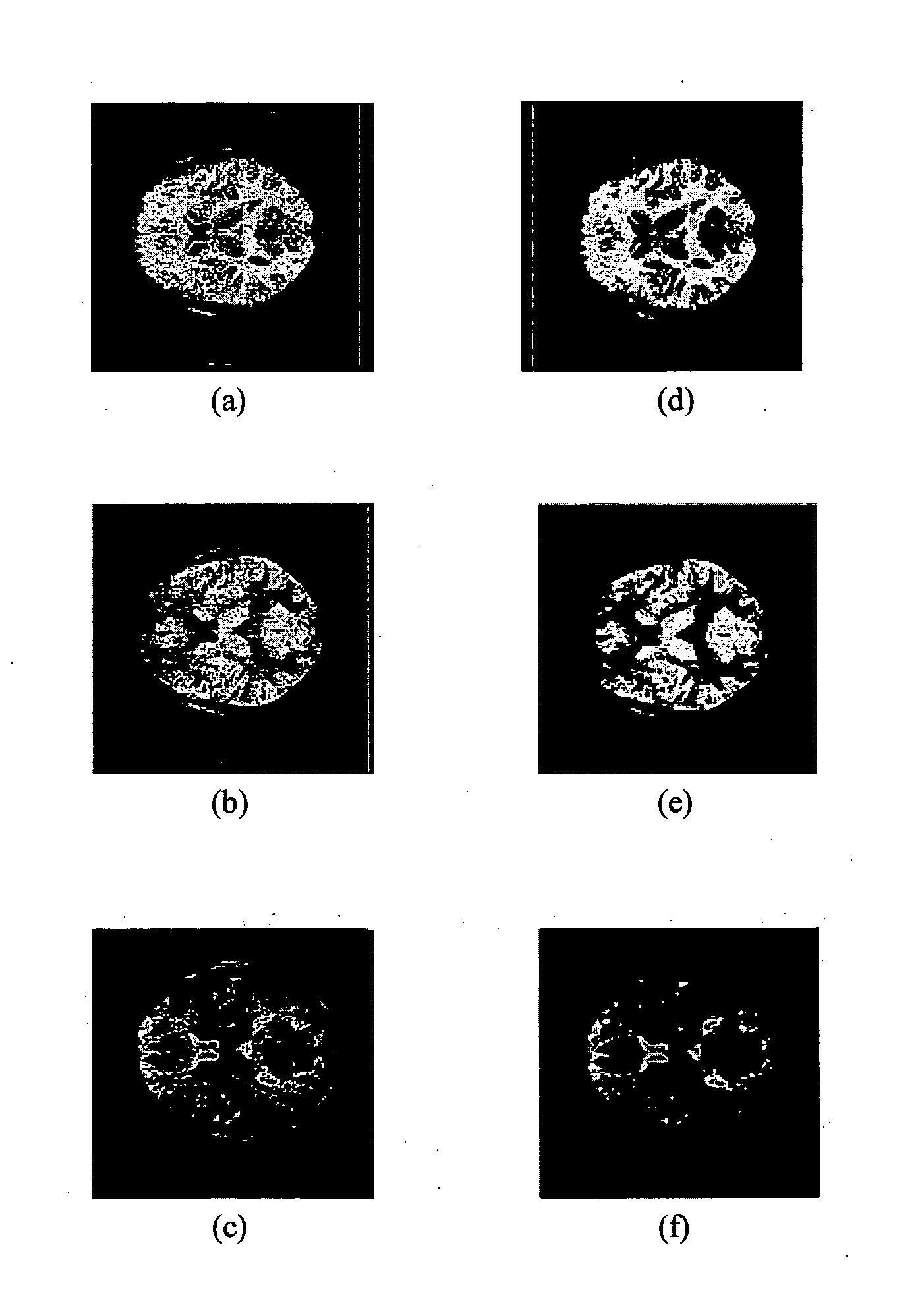 Method and system for segmenting a brain image