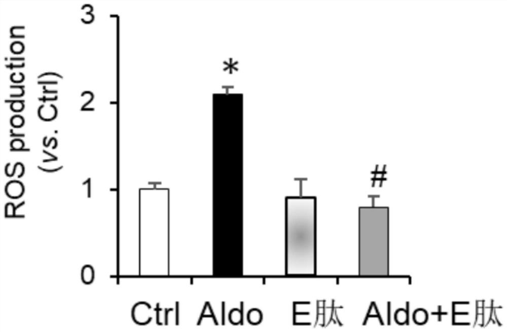 Application of Elabela polypeptide in preparation of antioxidant products