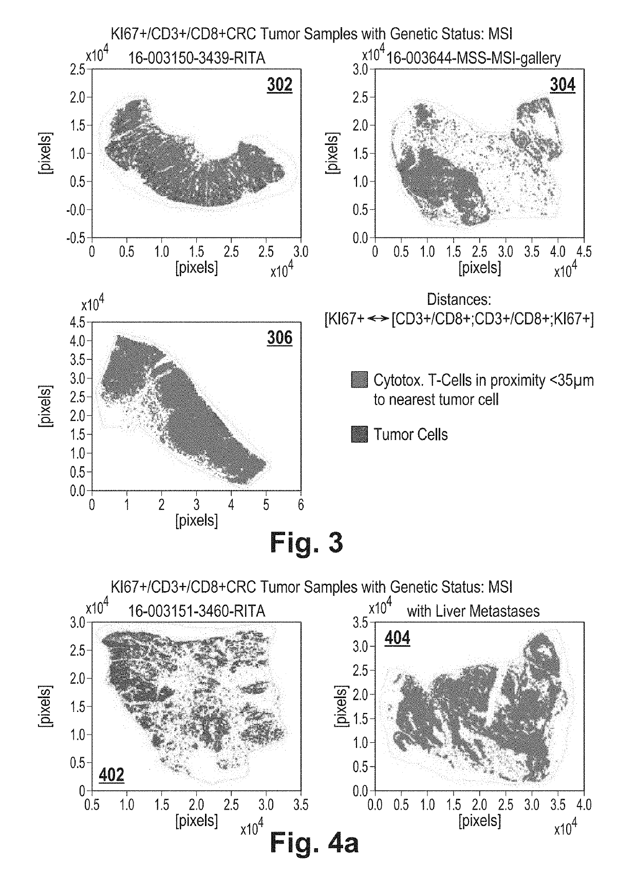 Tumor proximity measure