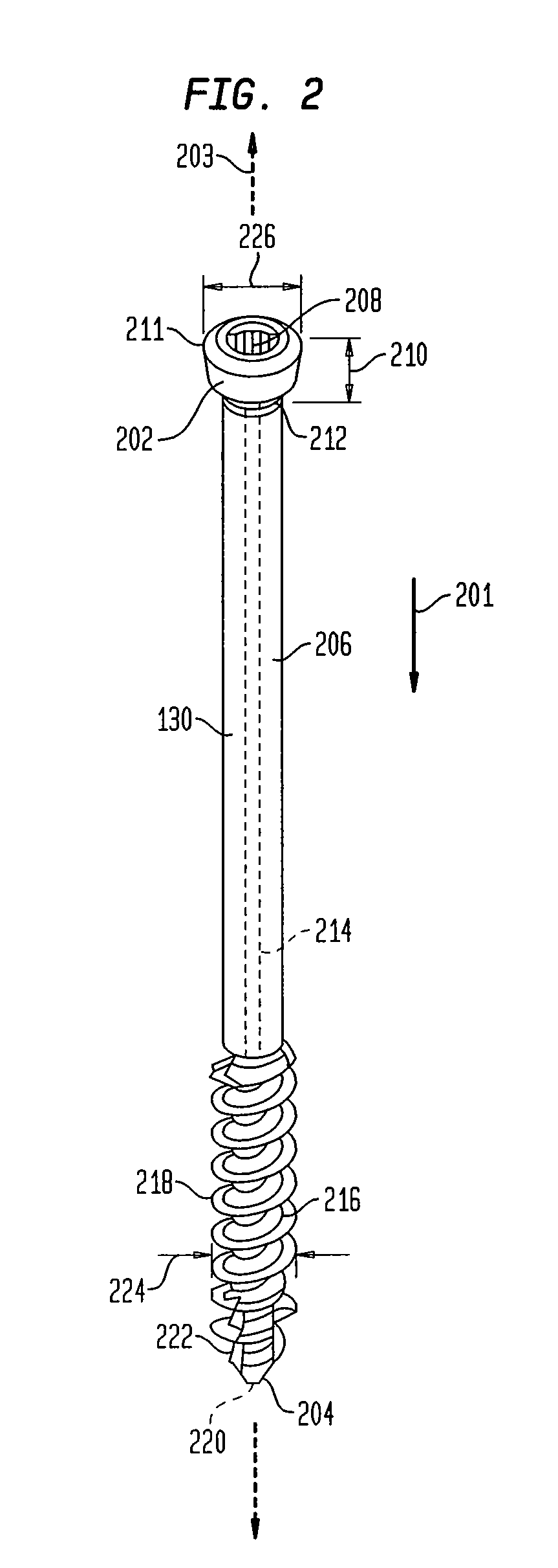 Hybrid intramedullary fixation assembly and method of use