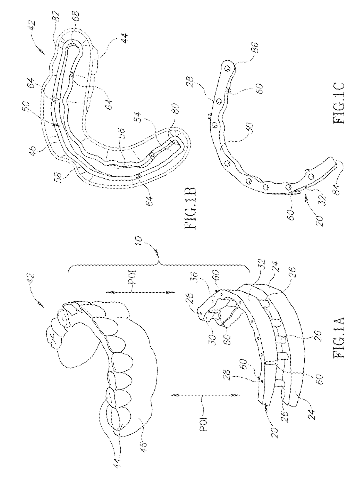 Positioning system