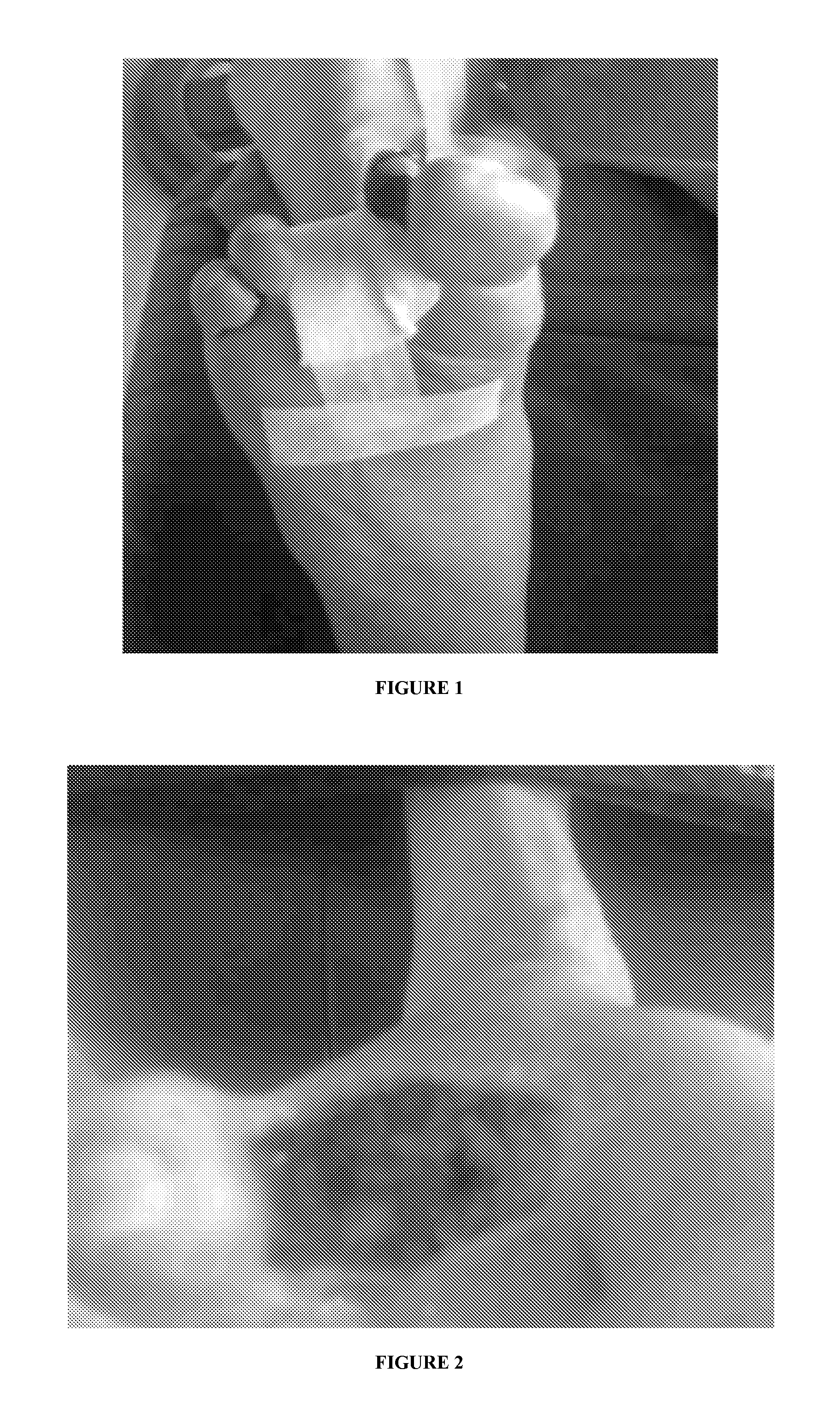 Method of managing diabetic foot ulcers, pressure ulcers, venous leg ulcers and associated complication