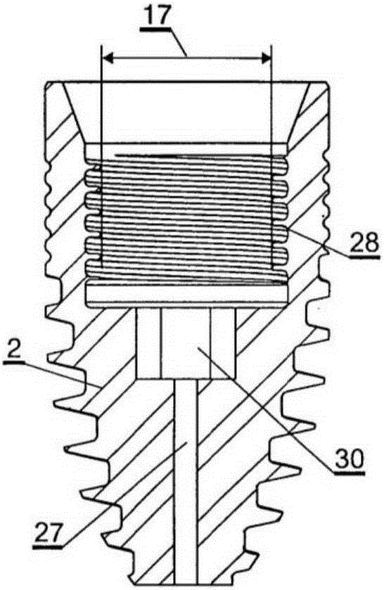 Dental device fixing unit