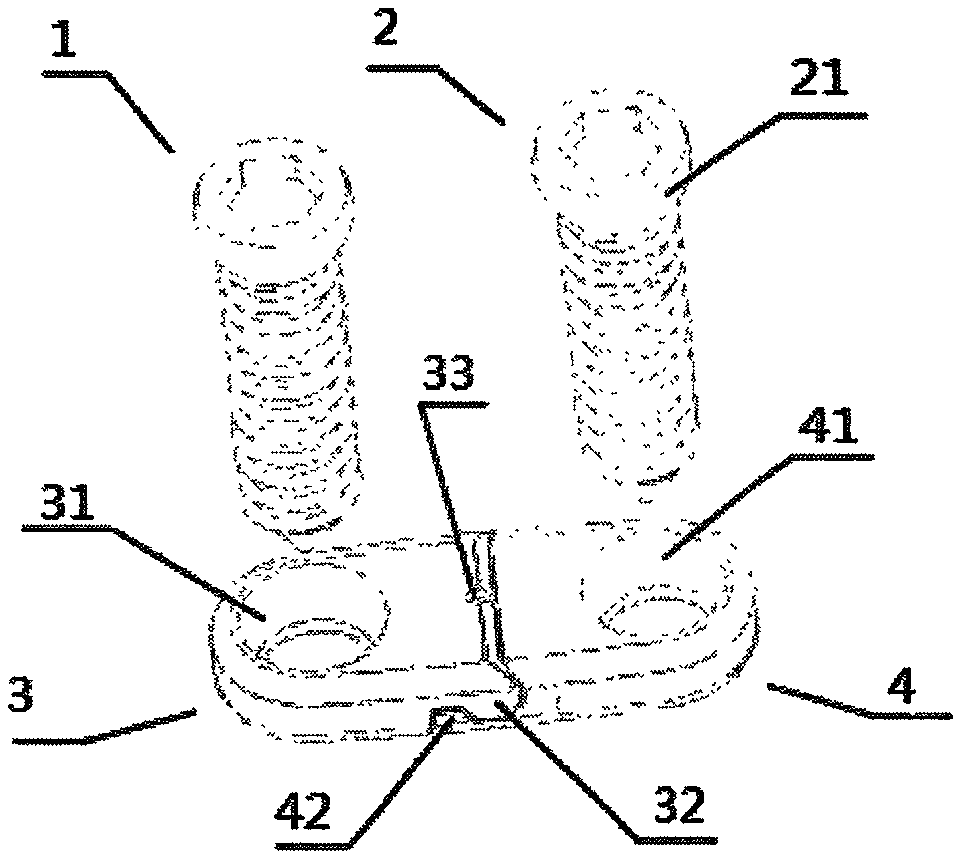 Splayed plate for child bone malformation orthopedics