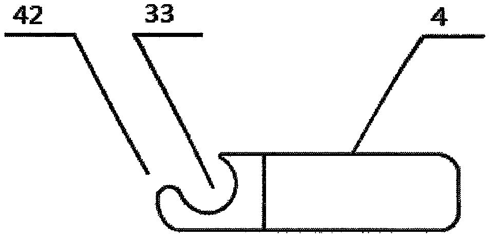 Splayed plate for child bone malformation orthopedics