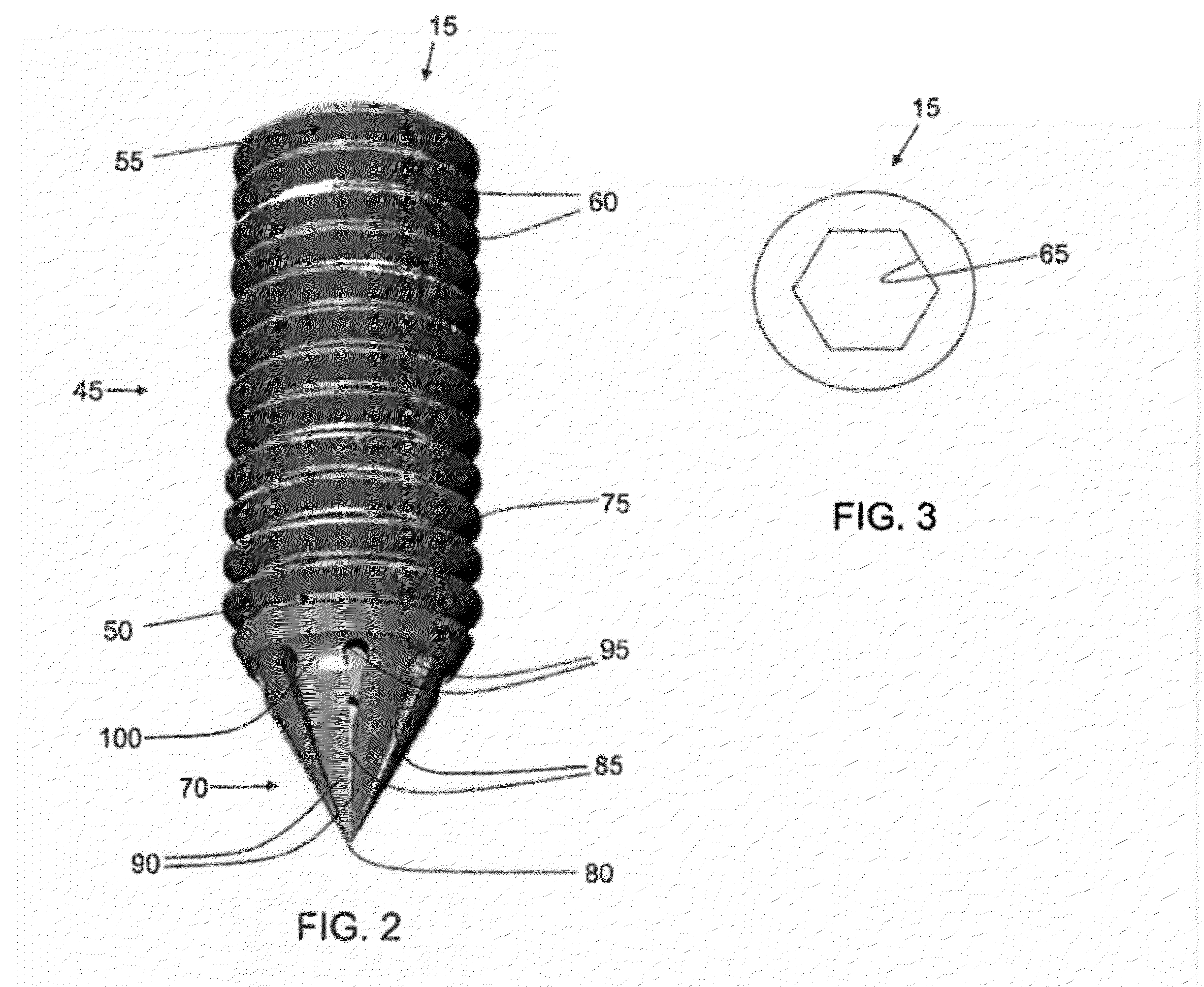 Method and apparatus for attaching soft tissue to bone