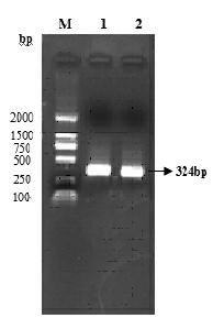 Newly found hepatitis C virus epitope