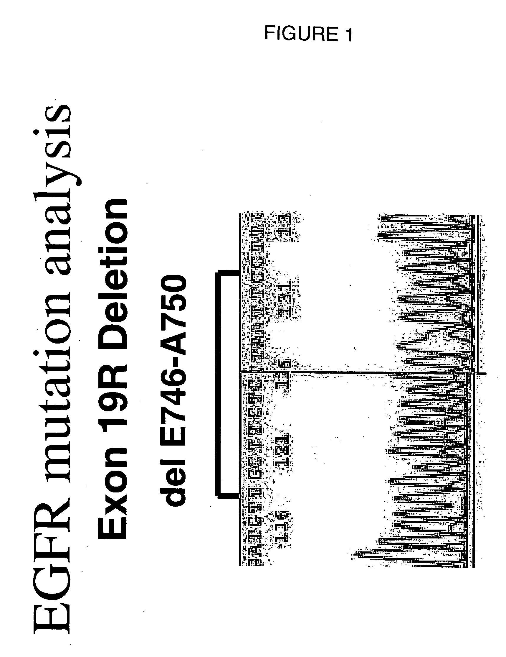 Use of an epidermal growth factor receptor kinase inhibitor (EGFR) in gefitinib resistant patients