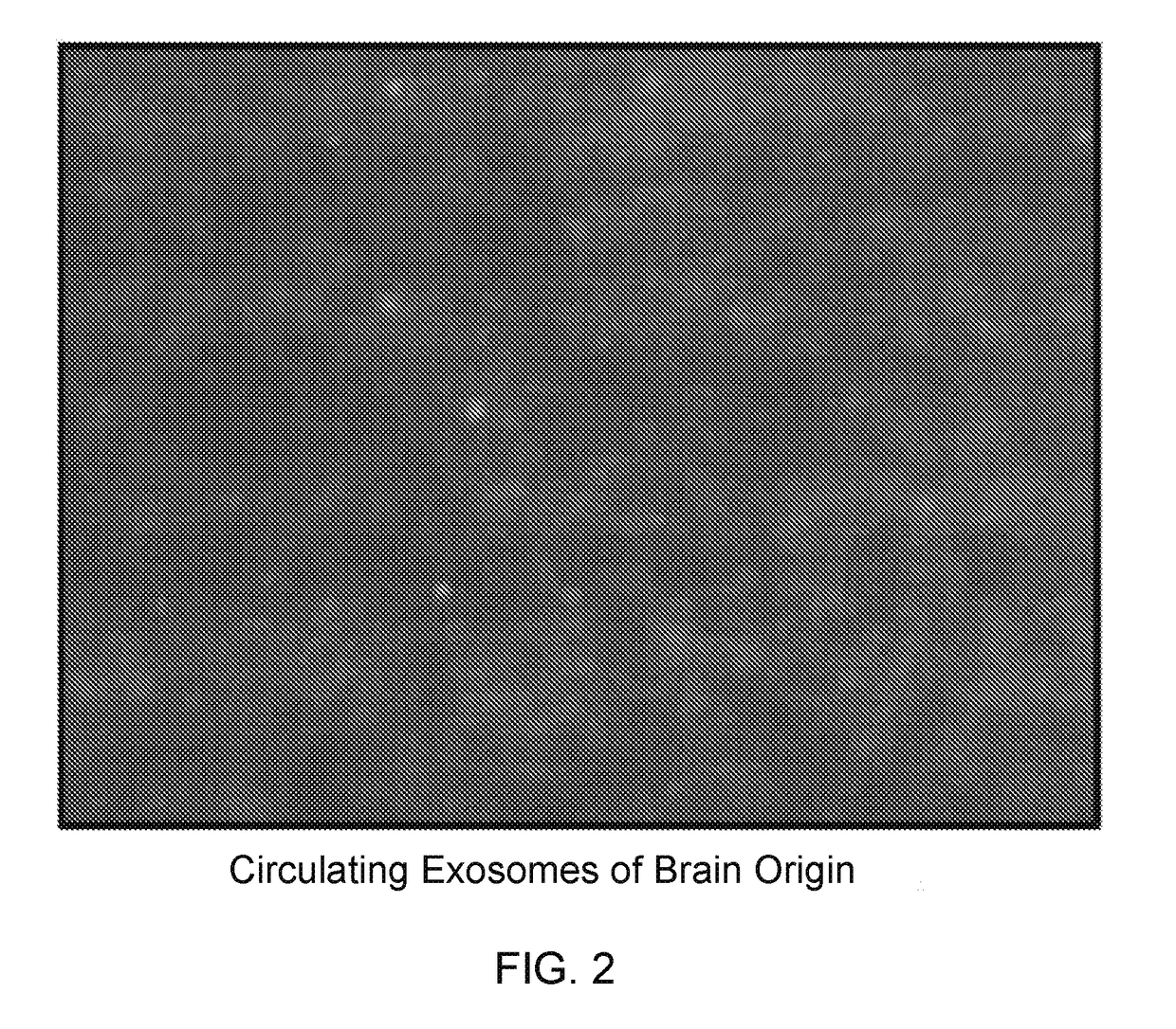 Exosomal tau as a biomarker for brain disorders