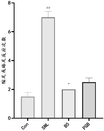 Analgesic uses of Pulsatillae or its extracts