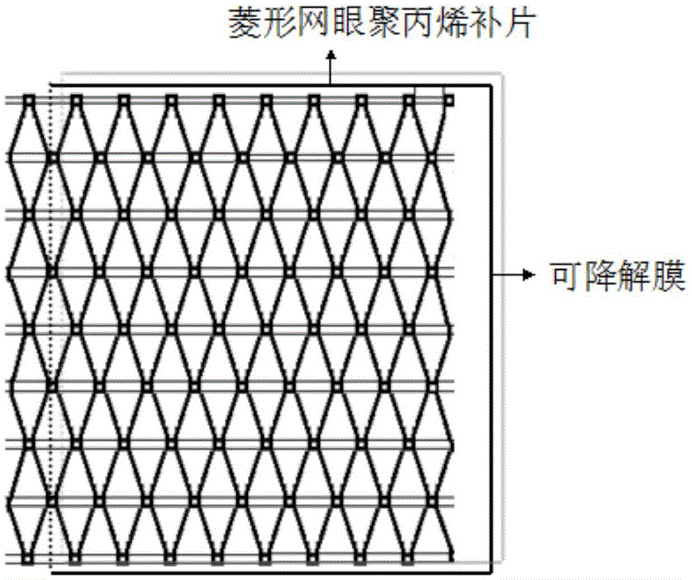 Polylactic acid/polycaprolactone/polypropylene composite pelvic floor patch and preparation method thereof