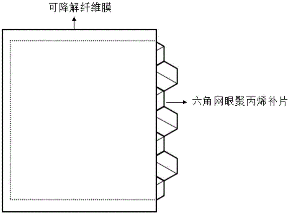 Polylactic acid/polycaprolactone/polypropylene composite pelvic floor patch and preparation method thereof