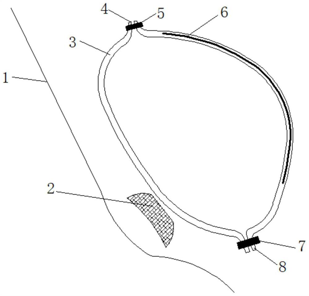 Intelligent bionic bladder device