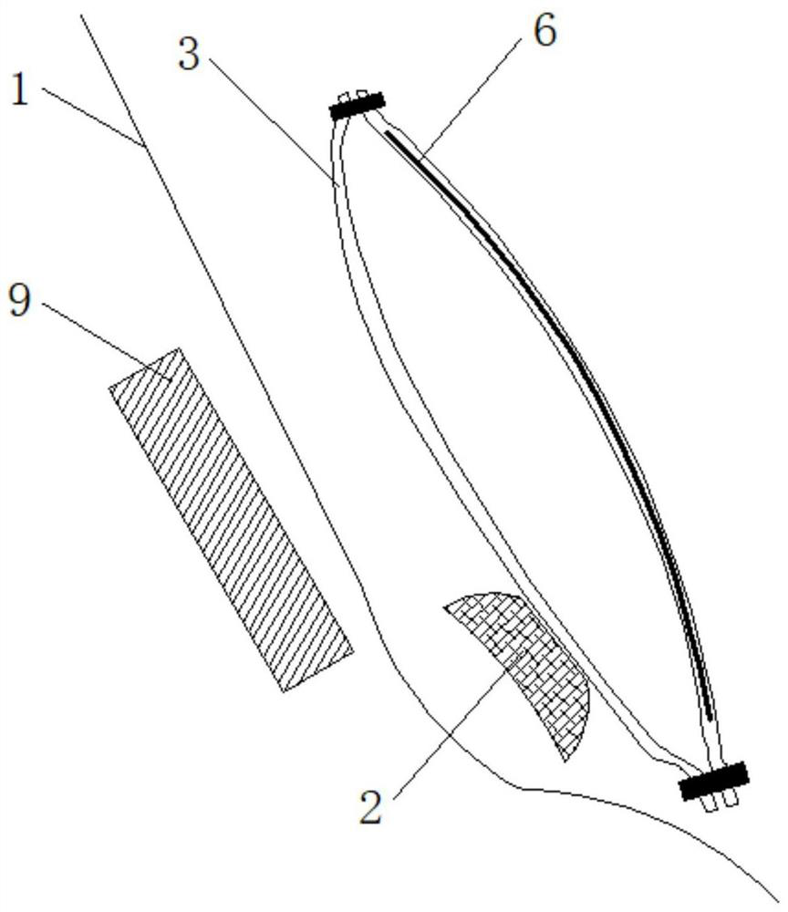 Intelligent bionic bladder device