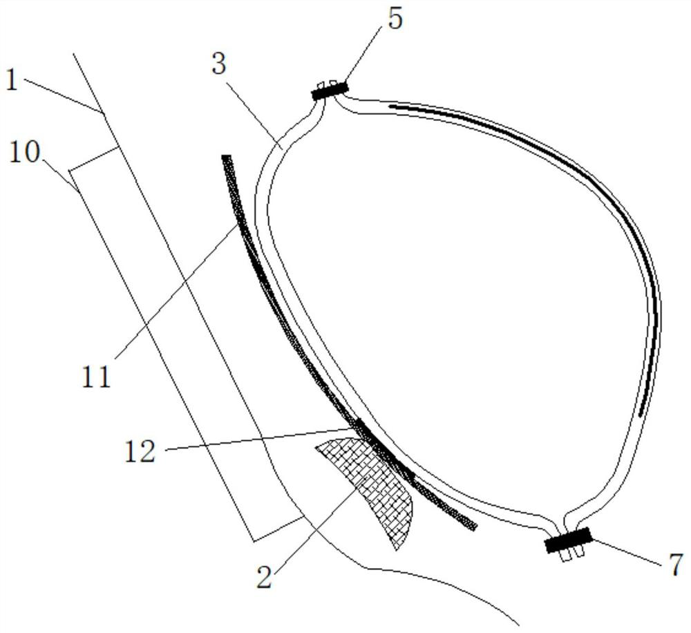 Intelligent bionic bladder device