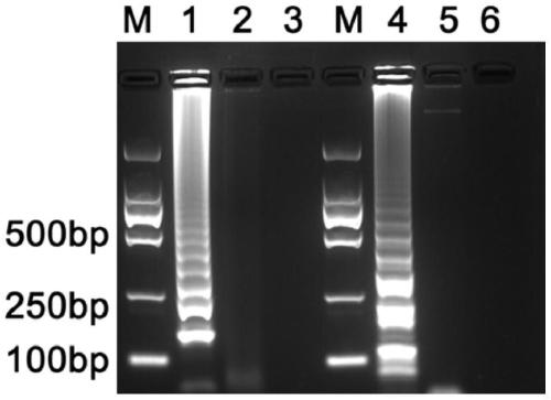 LAMP detection primer for sweet potato blast fungus and visual detection method of sweet potato blast fungus