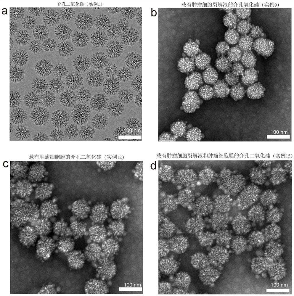 Hydrophilic antigen and/or hydrophobic antigen vaccine delivery system and preparation method thereof