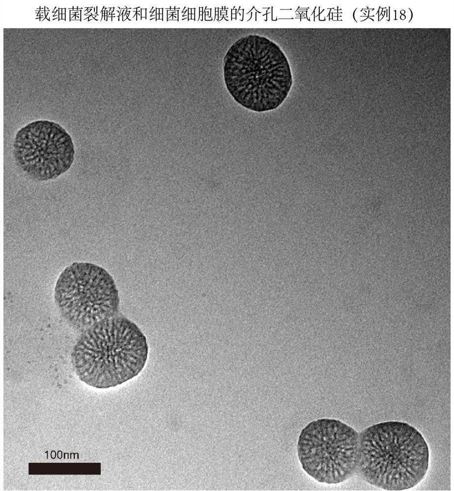 Hydrophilic antigen and/or hydrophobic antigen vaccine delivery system and preparation method thereof