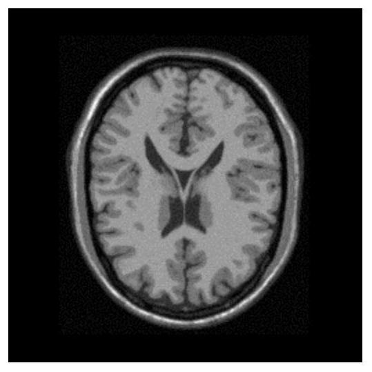 A method and system for non-rigid registration of multimodal medical images based on deep learning