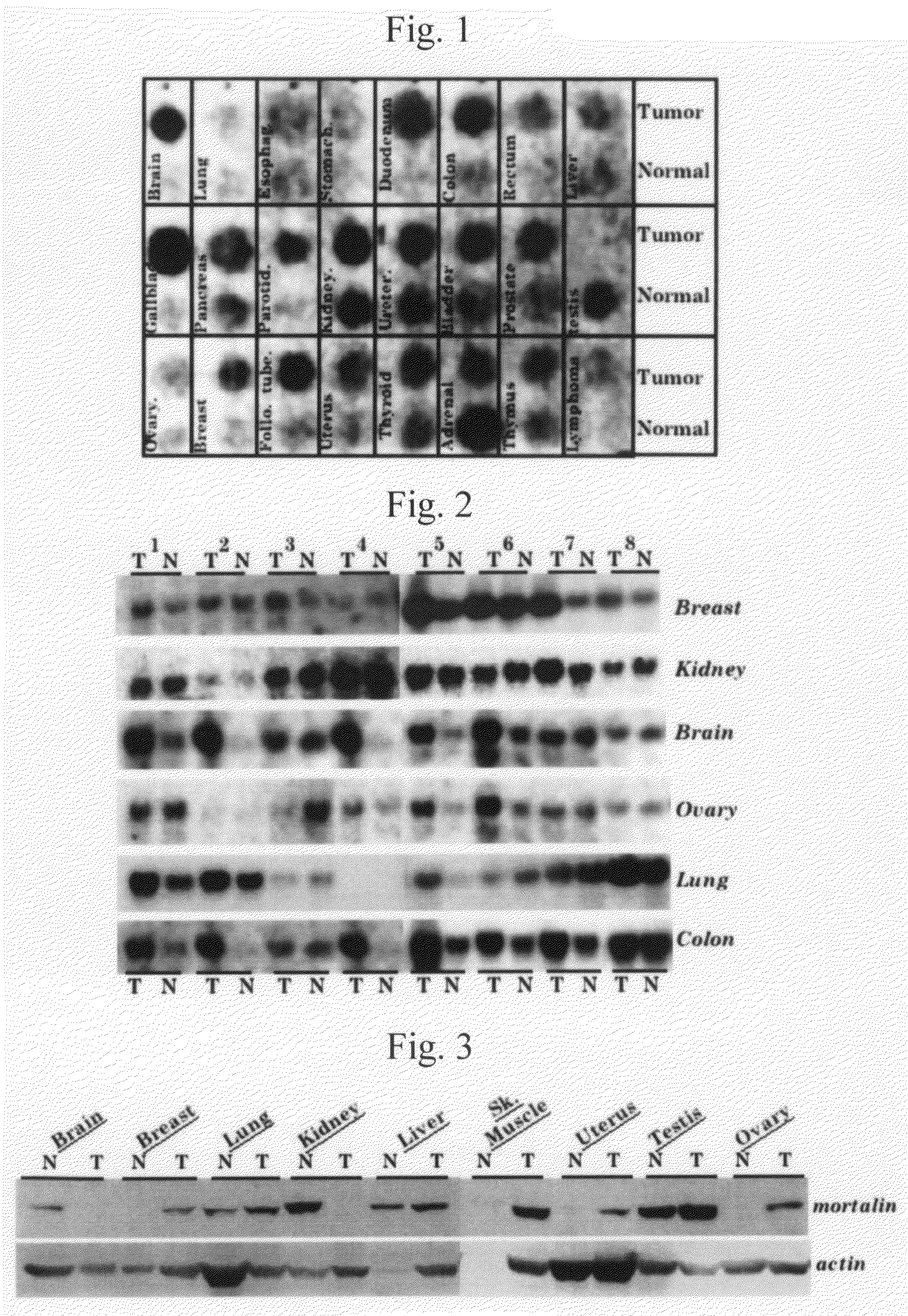 Use of anti-mortalin 2 antibody and functional nucleic acid for cancer therapies