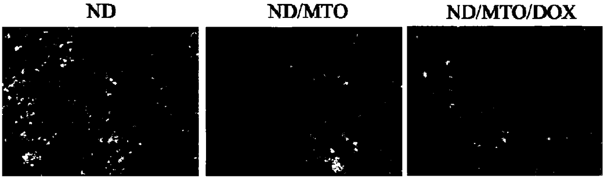 Composite nanodiamond medicine and preparation method and application thereof