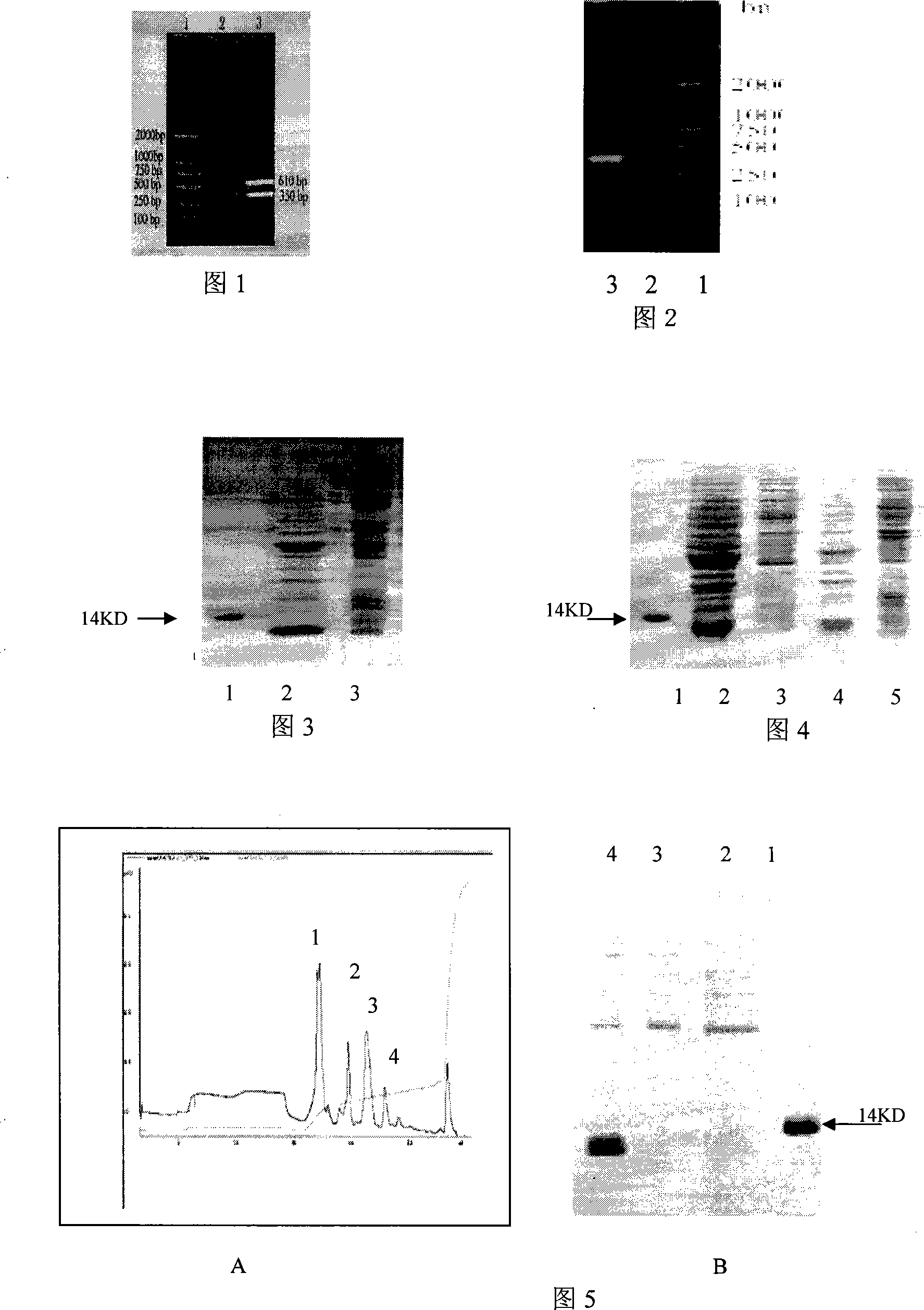 Recombinant polypeptide having islets beta- cell protection function