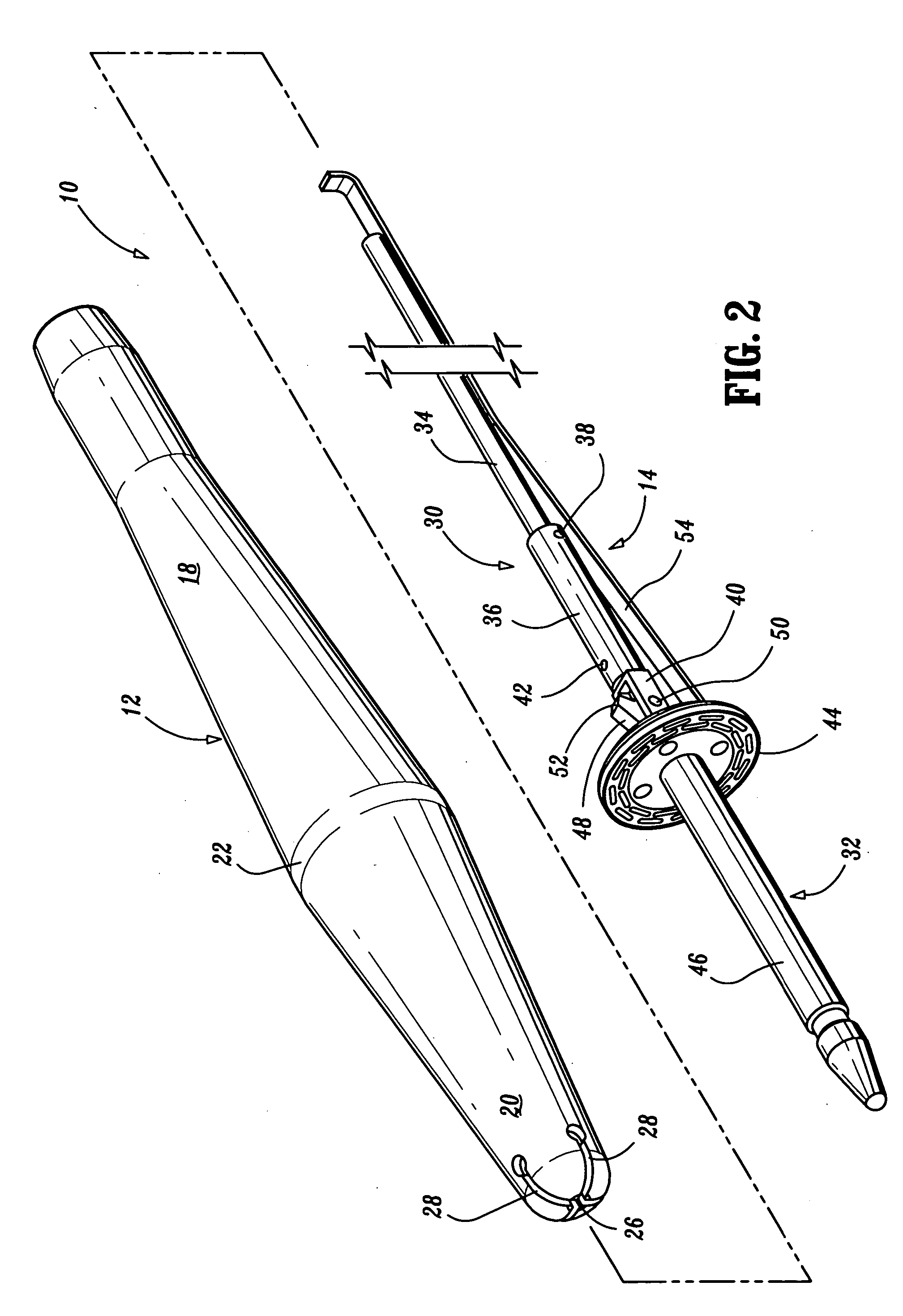 Apparatus and method for performing a bypass procedure in a digestive system