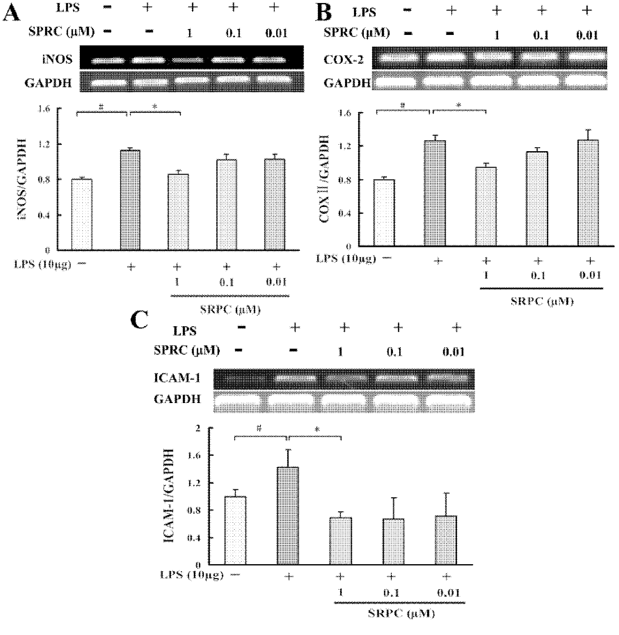 Application of propargyl cysteine and analogues thereof in preparation of medicaments for preventing and treating diseases related to cardiovascular system inflammation