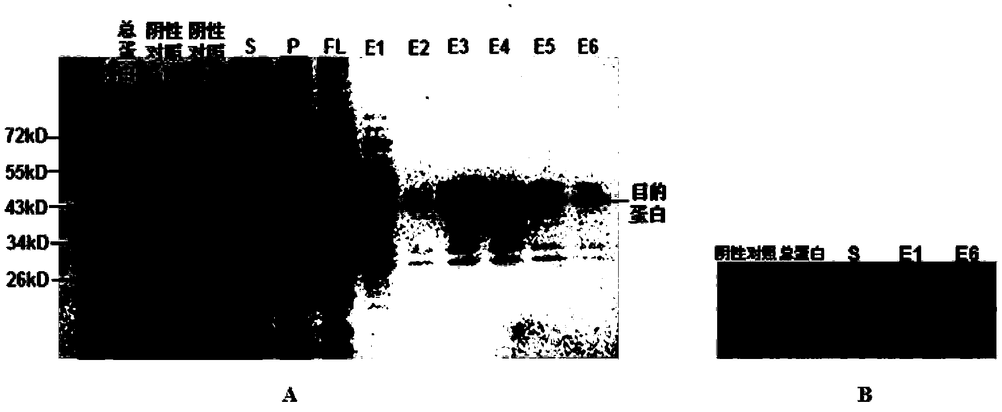 Soybean photosynthesis related gene GmDeg2 and application thereof