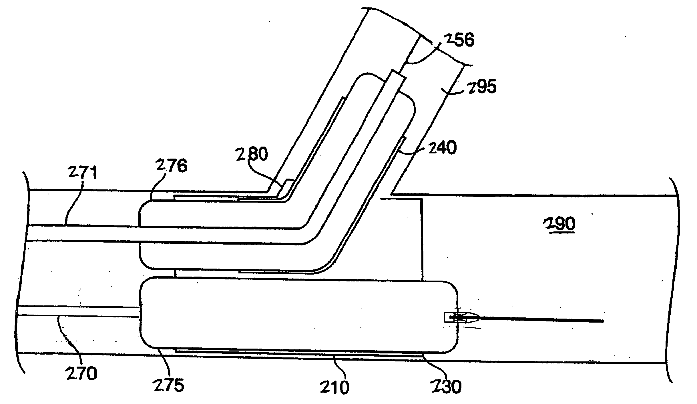 System and method for delivering a bifurcated stent