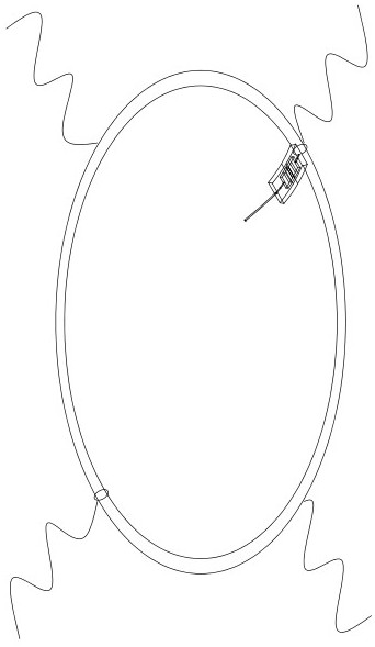 Glaucoma aqueous humor drainage device