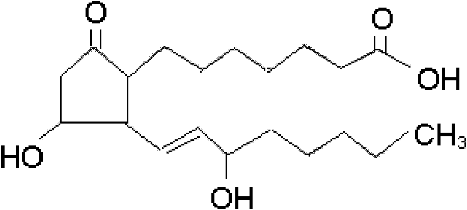 Alprostadil injection and preparation method thereof