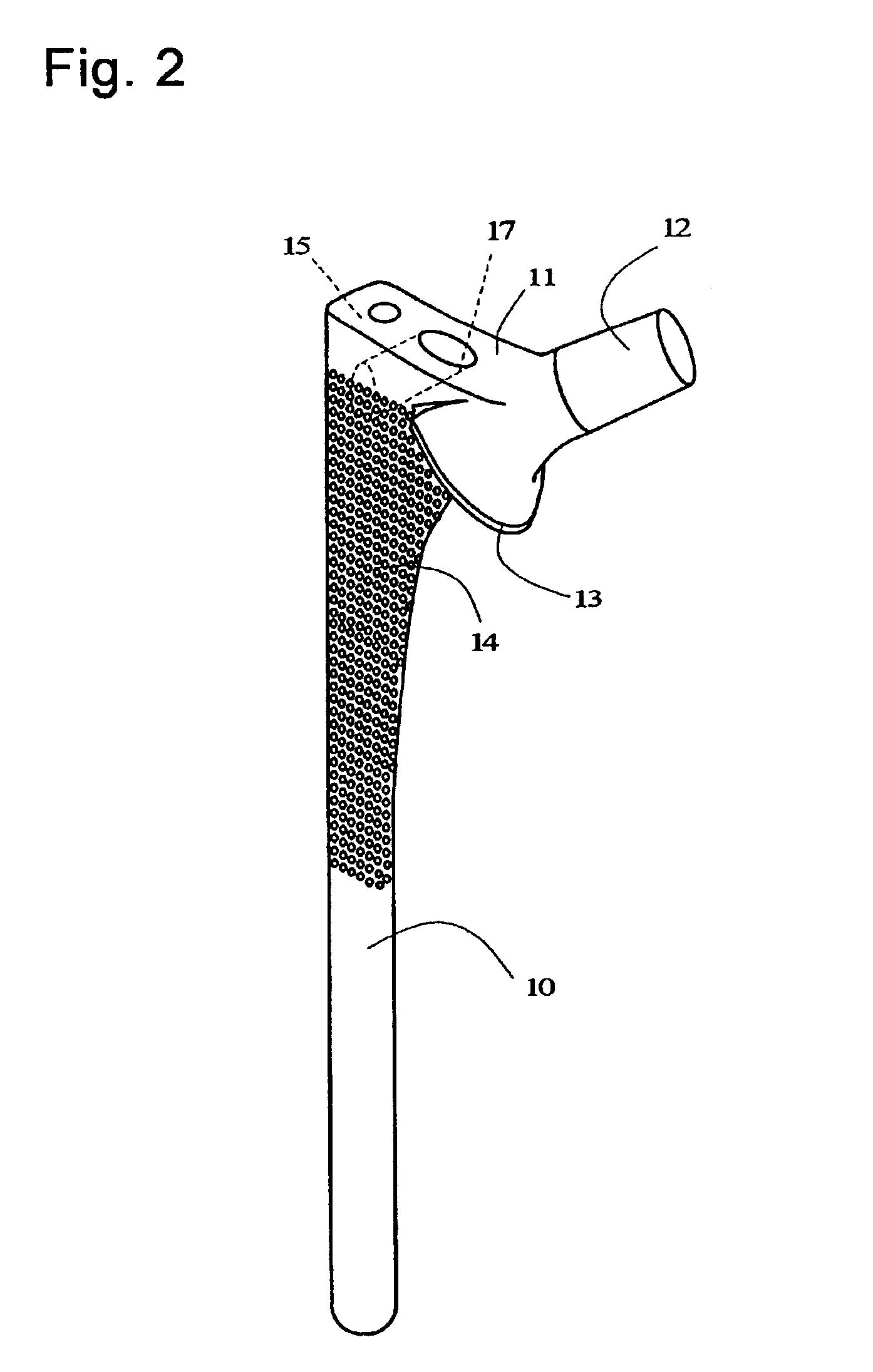 Stem of artificial hip joint