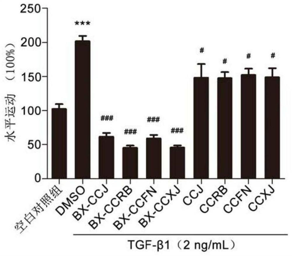 The invention also discloses application of vinblastine derivative in preparation of drug for inhibiting tumor metastasis