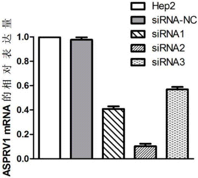 Application of ASPRV1 used as biomarker in diagnosis and treatment of LSCC (laryngeal squamous cell cancer)