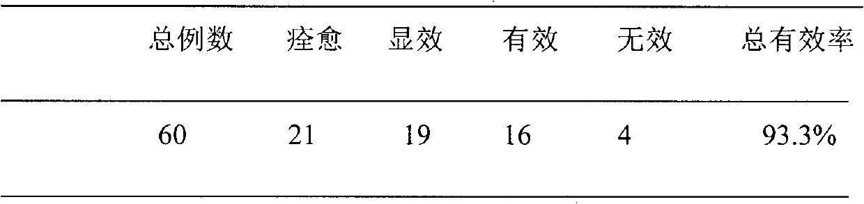 Traditional Chinese medicine composition for treating heart failure and preparation method and application thereof