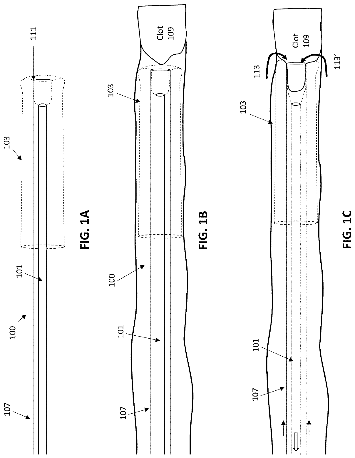 Inverting thrombectomy apparatuses and methods of use