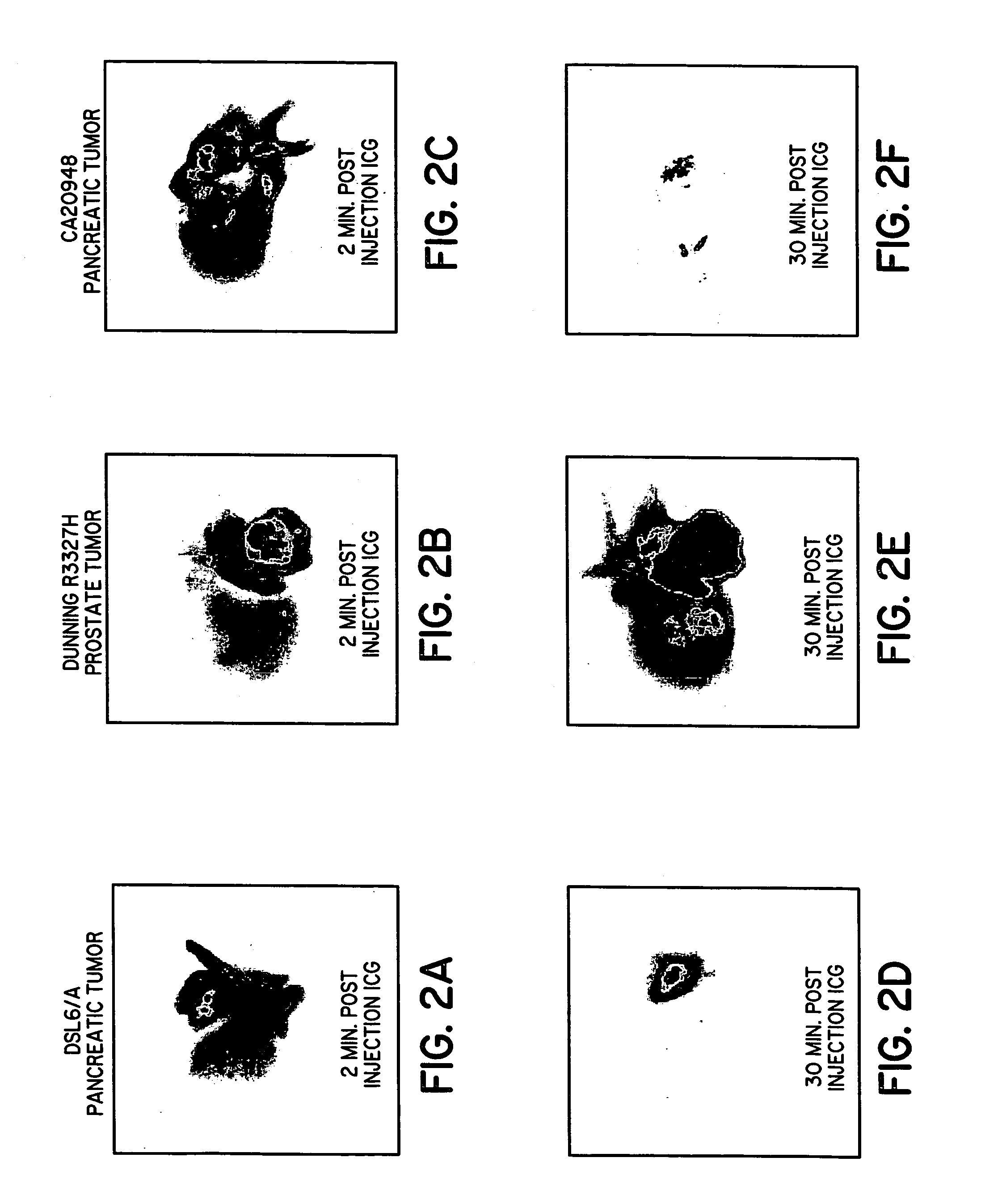 Pathological tissue detection and treatment employing targeted optical agents