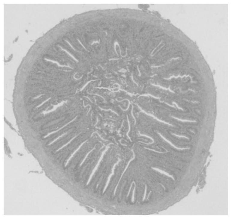 Micropterus salmoides low-fish-meal-content compound feed capable of improving intestinal health and preparation method thereof