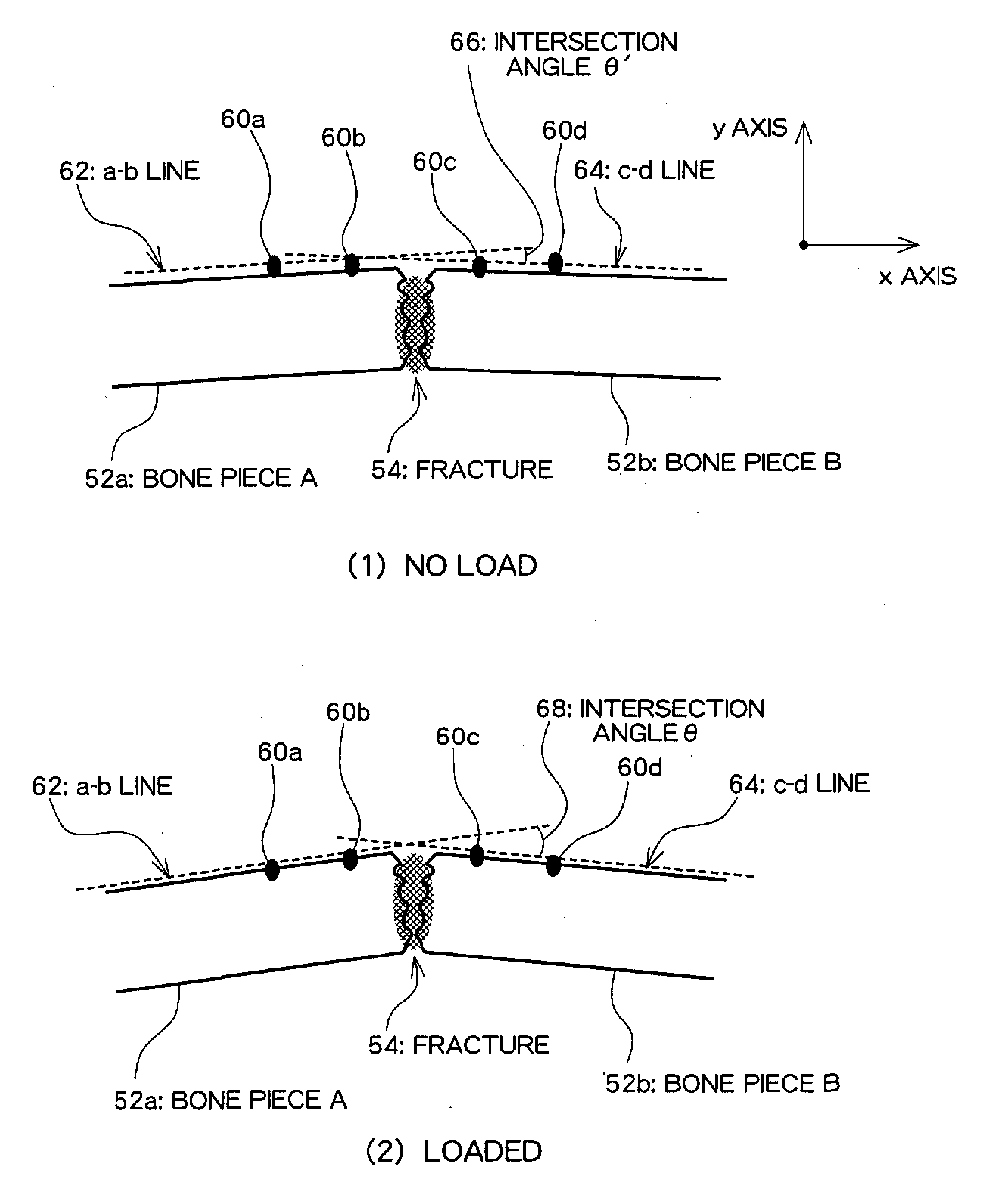 Ultrasound diagnosis apparatus