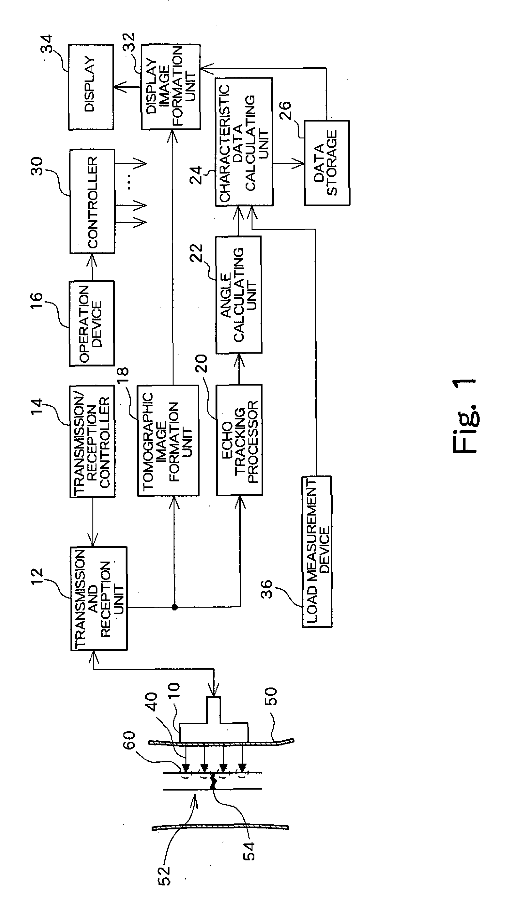 Ultrasound diagnosis apparatus