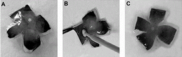 Separation culture method of human fetal retinal pigment epithelial cells