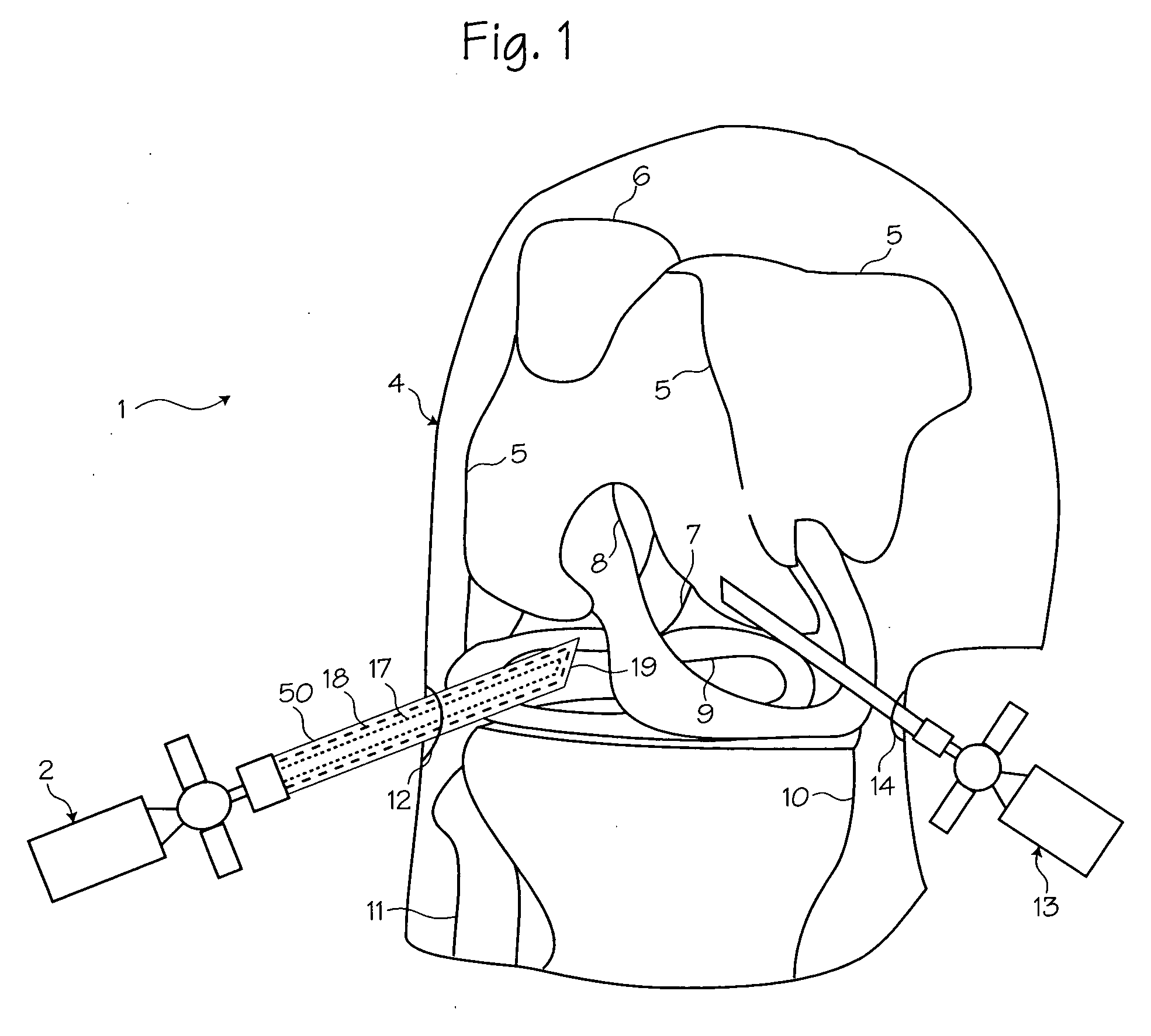 Atraumatic arthroscopic instrument sheath