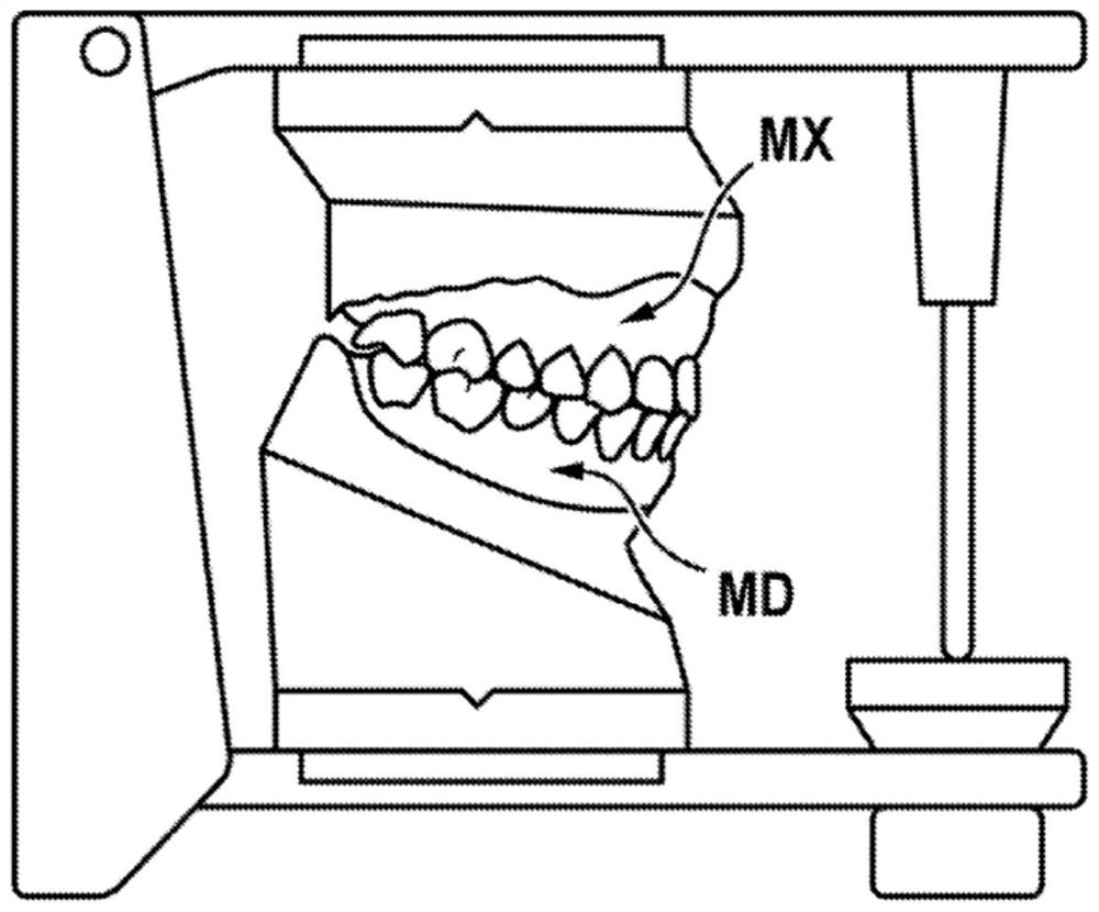 Method for animating models of the mandibular and maxillary arches of a patient in a corrected intermaxillary relationship