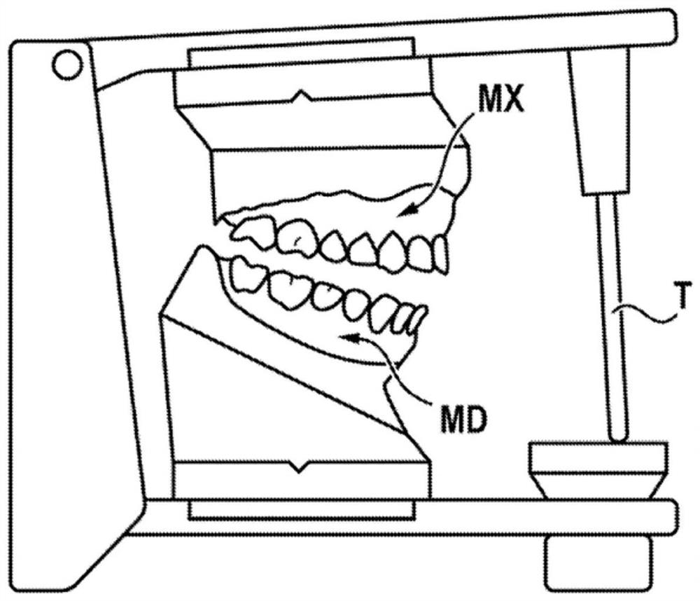 Method for animating models of the mandibular and maxillary arches of a patient in a corrected intermaxillary relationship