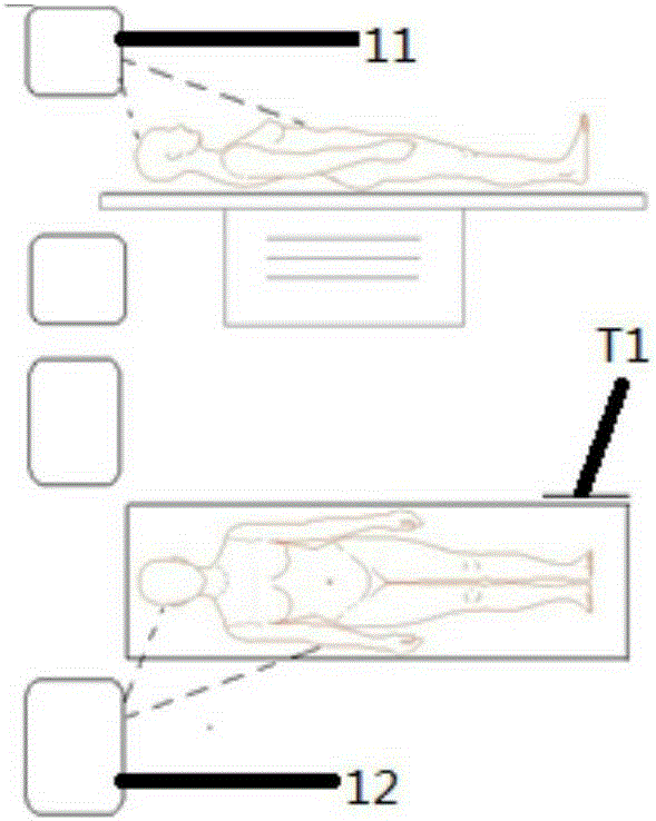 Body surface location method and device