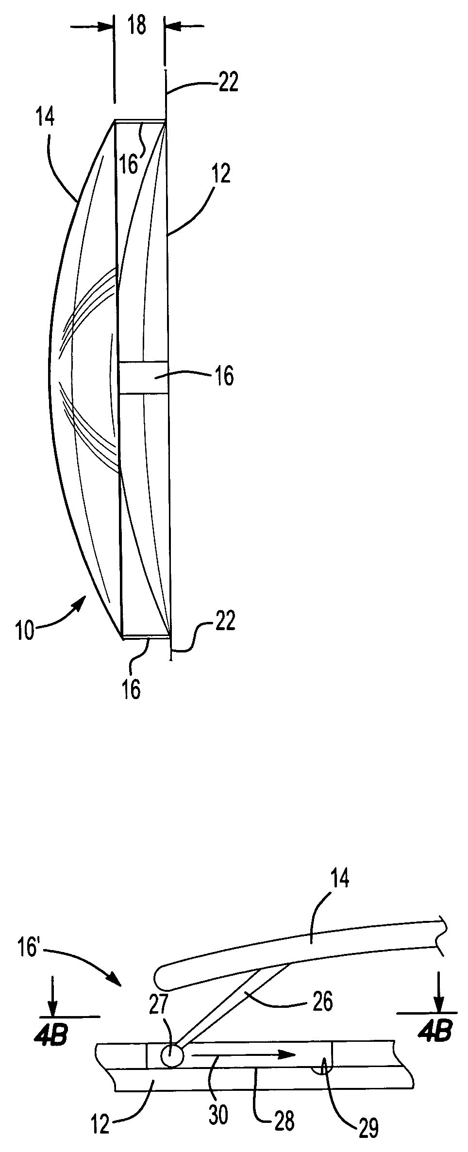 Posterior chamber lens implant