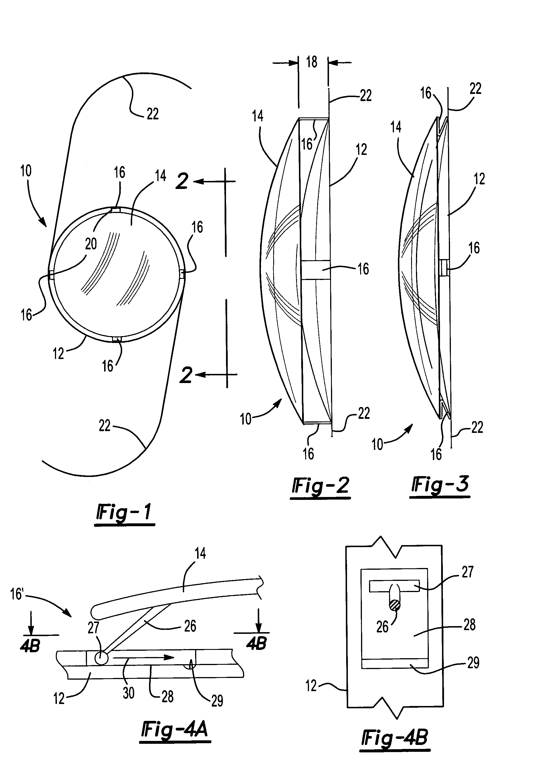 Posterior chamber lens implant